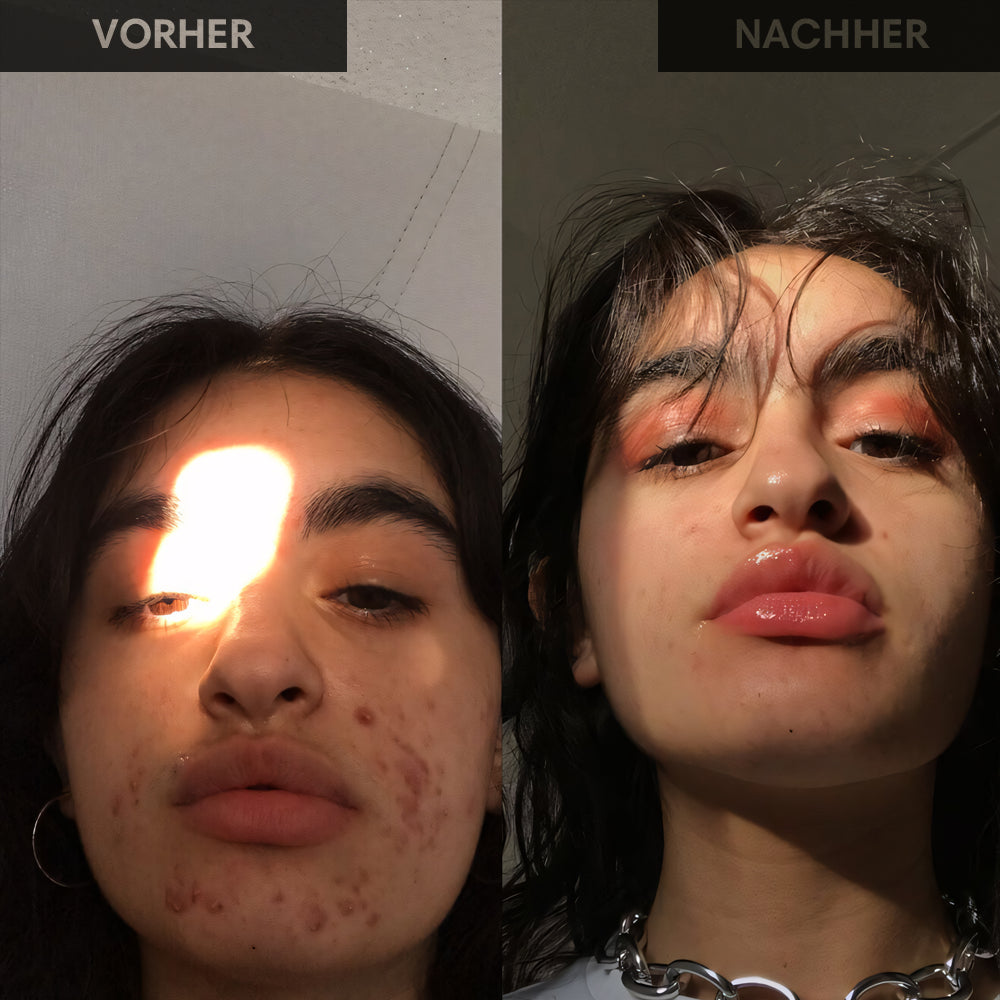Brightening und Lifting Mask mit Grüntee