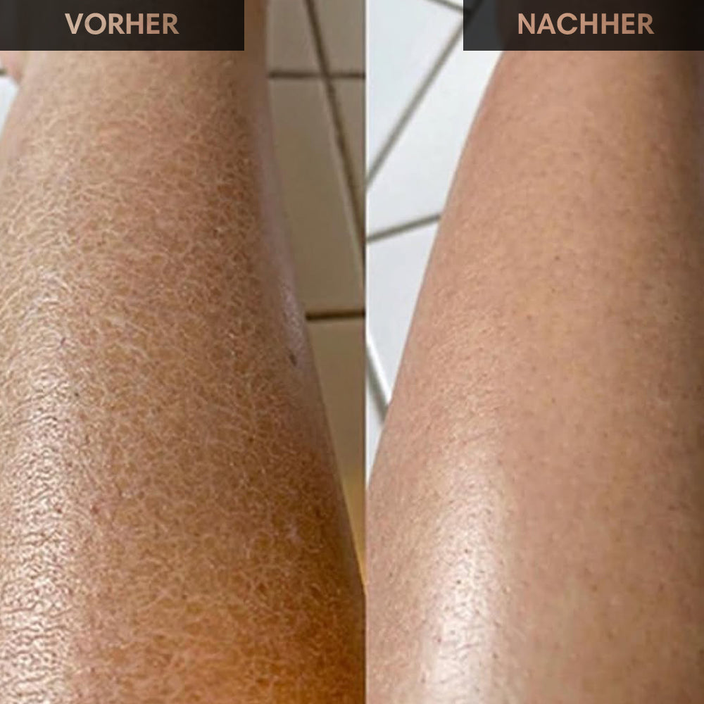 Körperlotion Intensive